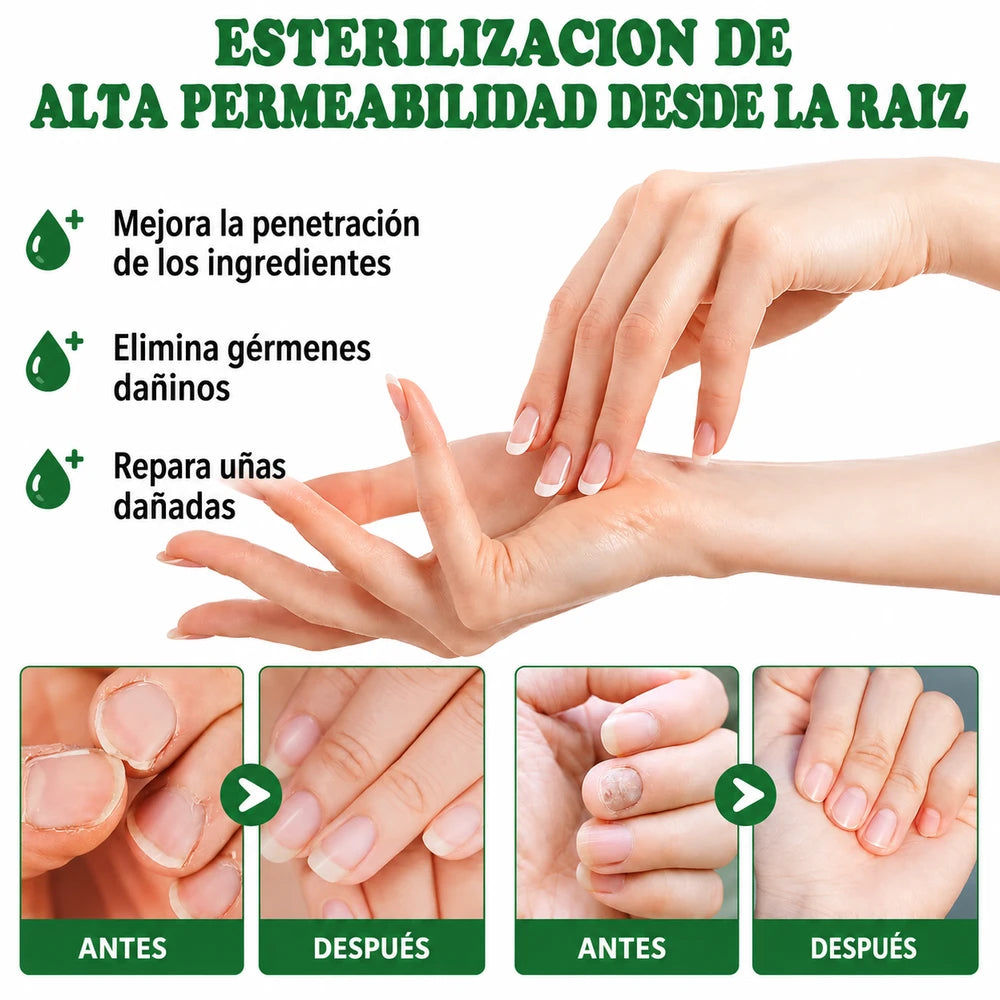 Elimina el hongo en 7 días