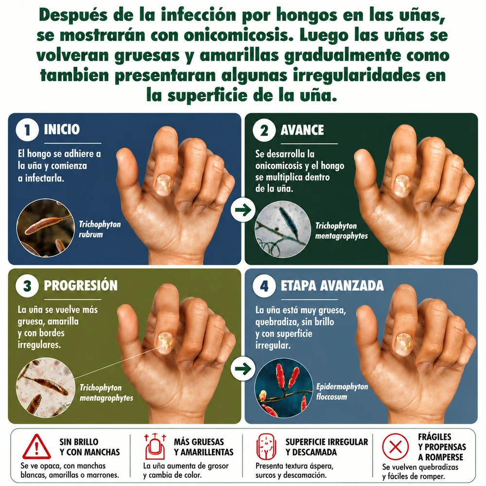 Elimina el hongo en 7 días